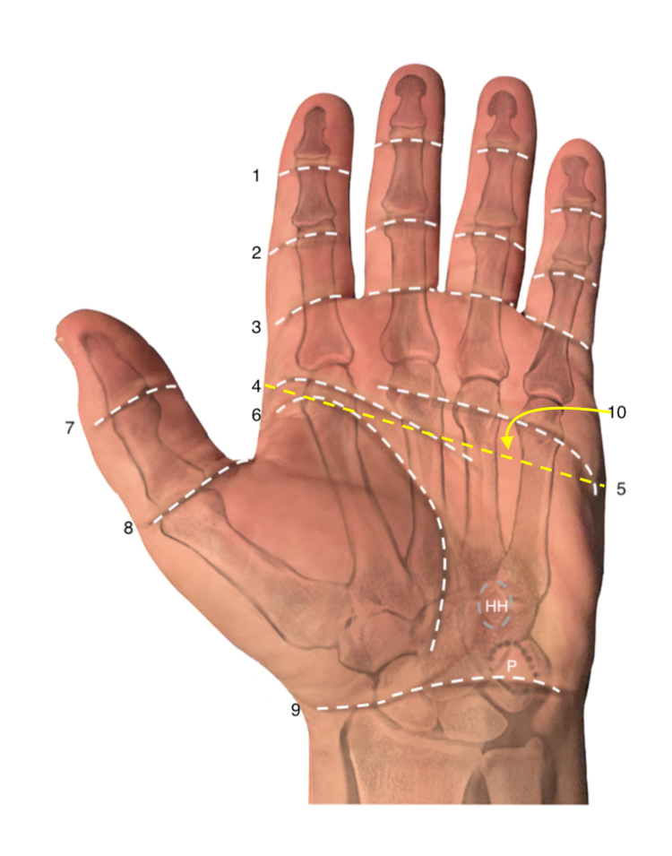 Surface Anatomy Hand Surgery Source